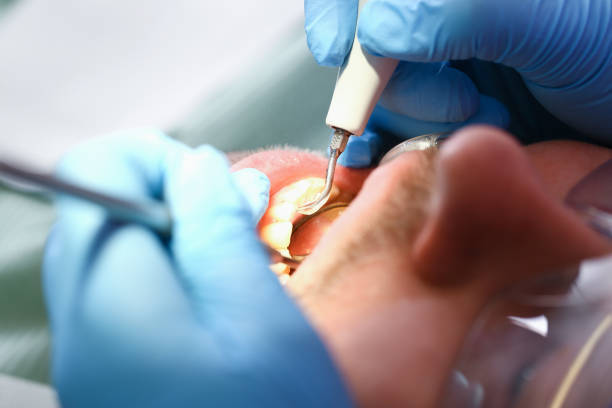 Best Emergency TMJ Treatment in Longbranch, WA