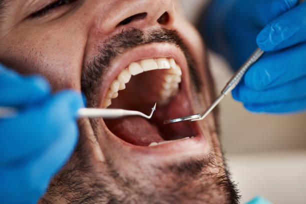 Best Emergency Gum Treatment in Longbranch, WA