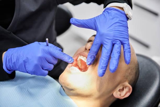 Best Emergency Treatment for Dental Infections or Abscesses in Longbranch, WA